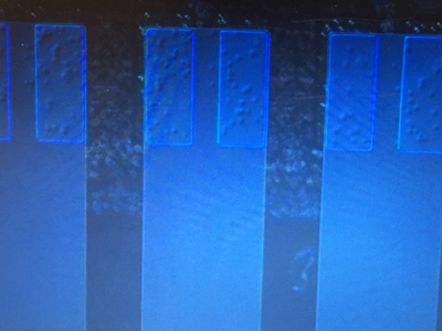 撮像例2:DICあり